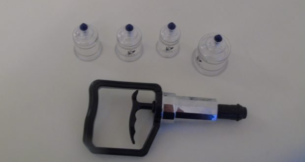 Sport e salute, tecniche di fisioterapia: la cupping therapy
